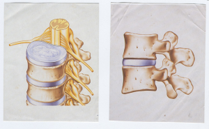 illustration of disks of spine