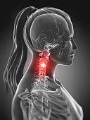illustration of neck pain